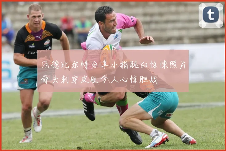 范德比尔特分享小指脱臼惊悚照片骨头刺穿皮肤令人心惊胆战